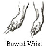 bowed wrist