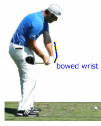 Bowed Wrist